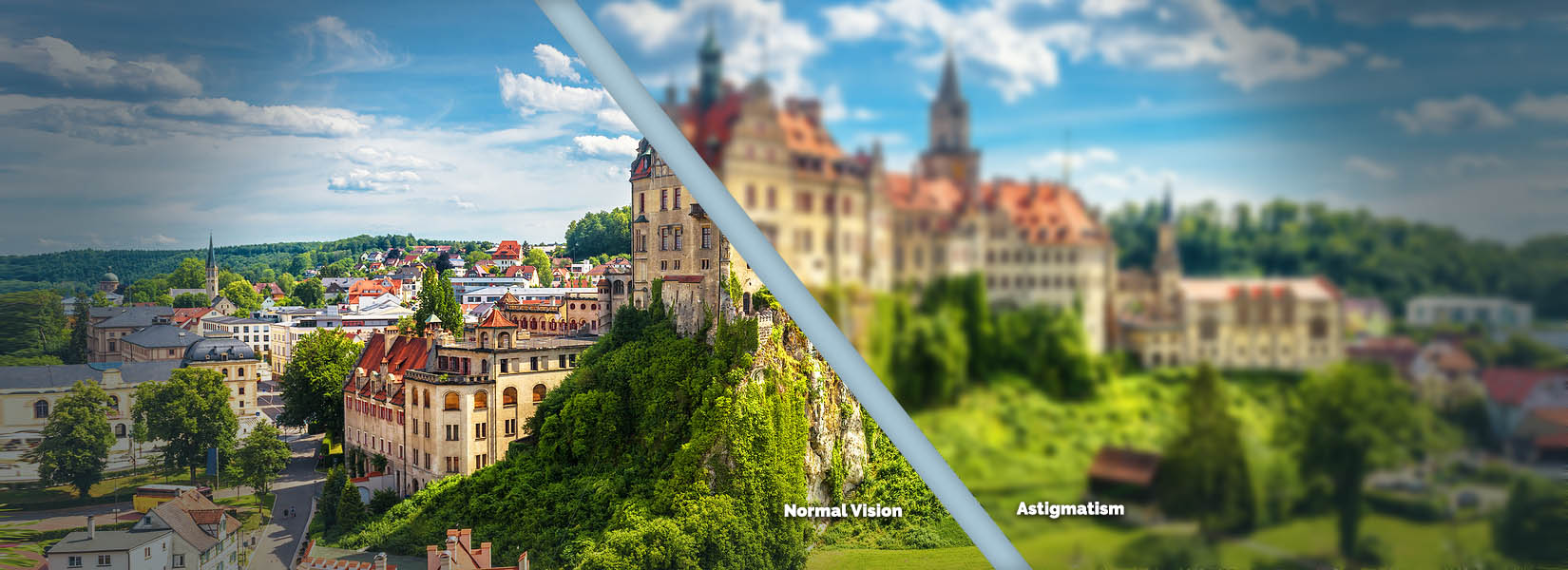 Astigmatism Treatment in Mentor