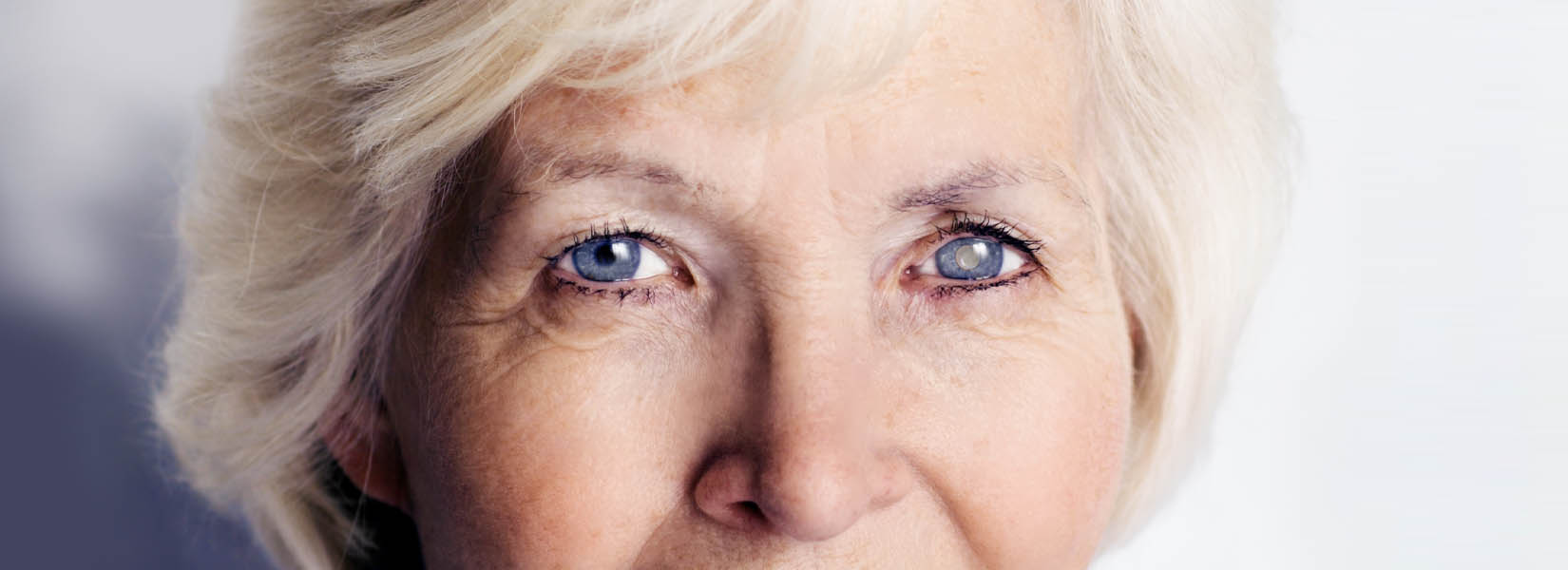 Cataract Surgery in Mentor